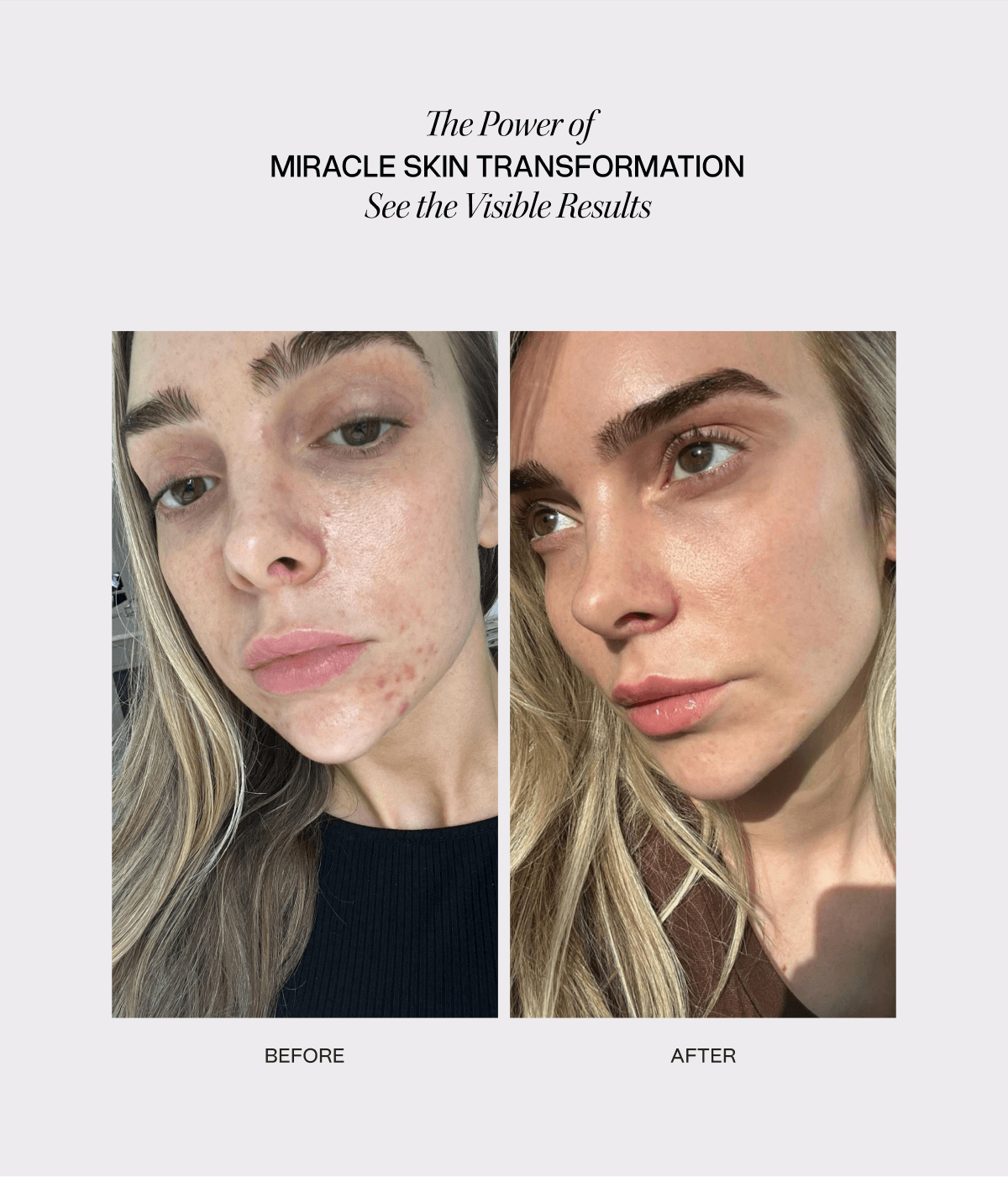 Miracle Transformation Duo