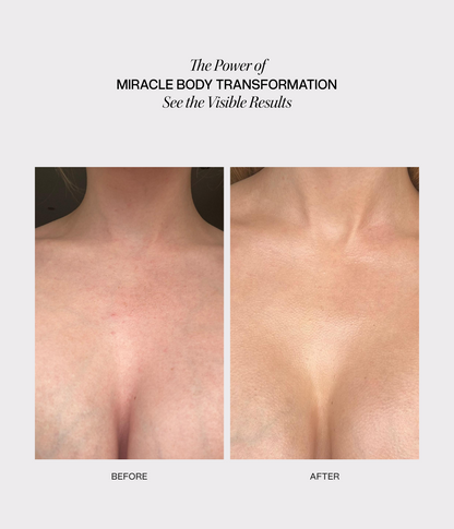 Miracle Transformation Duo